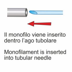 Stonfo Wind-On Needles